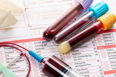 راهنمای کامل آزمایش خون | اقتصاد24