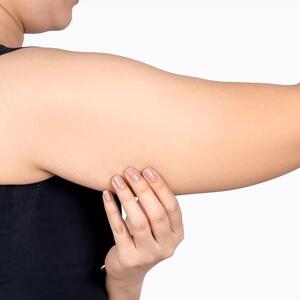 لیپوماتیک بازو چیست و چگونه انجام می شود؟