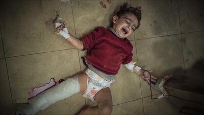 پزشک یهودی آمریکایی از جنایاتی که در غزه چشم خود دیده است، می گوید/ شلیک به سر عمدی، بدن های تکه پاره و چیزهایی دیدم که در تمام عمرم تجربه نکرده بودم! (+فیلم و عکس)